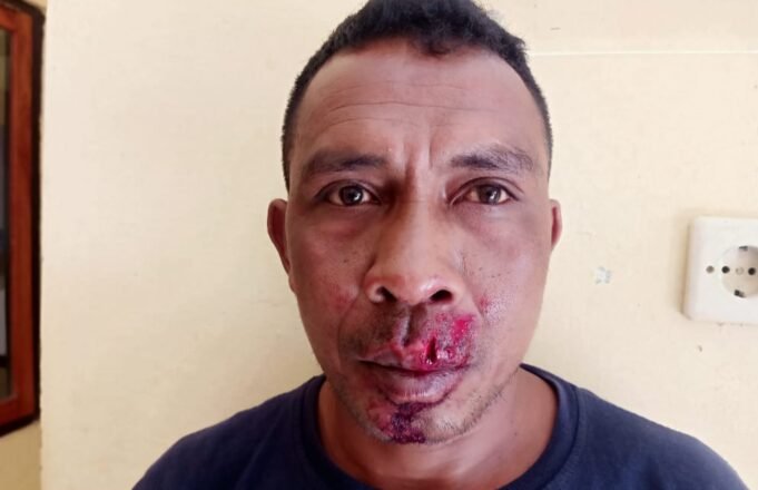 Oknum Lurah Olafulihaa Bersama Devi Tulle Aniaya Sopir Truck hingga Babak Belur