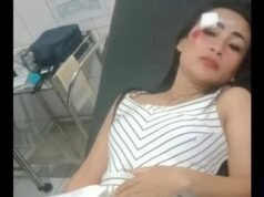 Sadis Kawanan Begal Bawa Clurit di Purwakarta, Korban luka luka Motor Raib