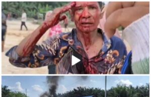 Tragis ! Warga Kerapatan Adat Sakai Terluka Diserang Karyawan PT SIS